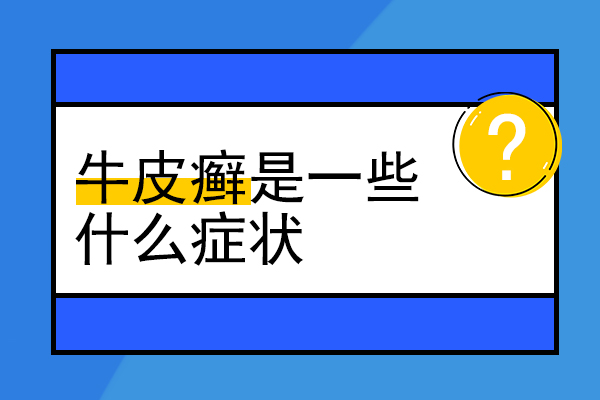 牛皮癣长在脸上怎么办,莫崩溃,贵阳牛皮癣专科医院【很可靠】