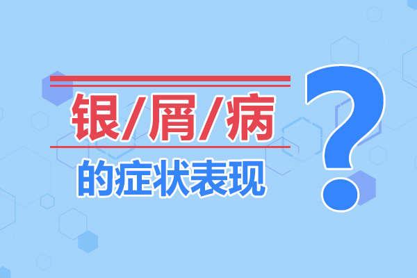 心态影响病情,银屑病患者该如何进行自我心理调节呢？